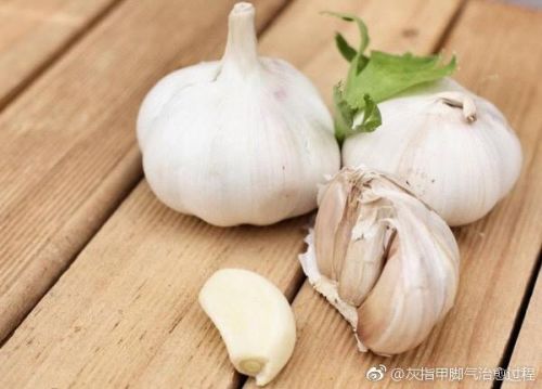 醋蒜治灰指甲(醋蒜液治灰指甲要多久)-第1张图片-