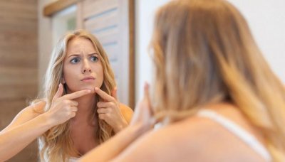 ​祛痘第一步，先了解痘痘的类型，对痘出招才管用