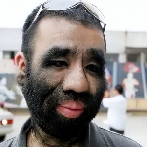 ​轰动一时“毛孩”于震寰，娶90后娇妻坚持生子，如今孩子还好吗？